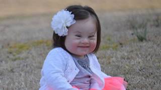 http://www.christianconcern.com/our-concerns/abortion/doctors-put-price-on-lives-of-those-with-downs-syndrome